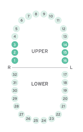 upper-molar-sidebar